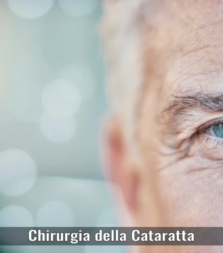 chirurgia-della-cataratta-oculistica-ranno-como-milano