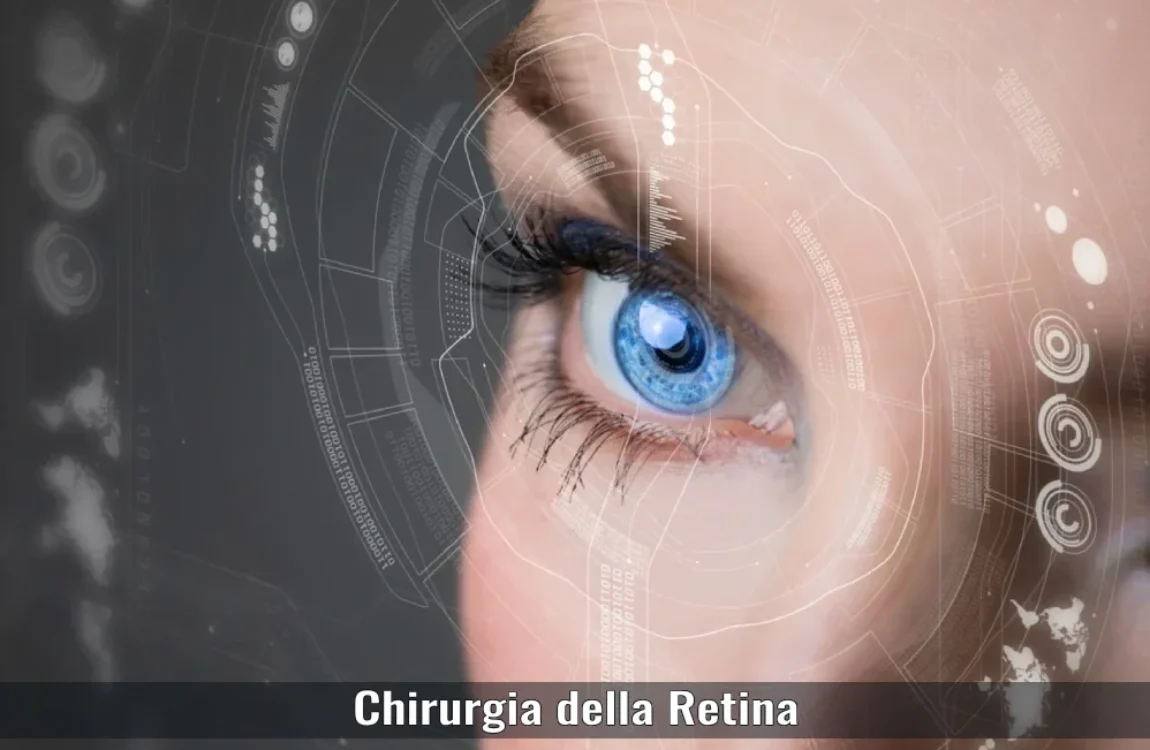 chirurgia-della-retina-oculistica-ranno-como-milano