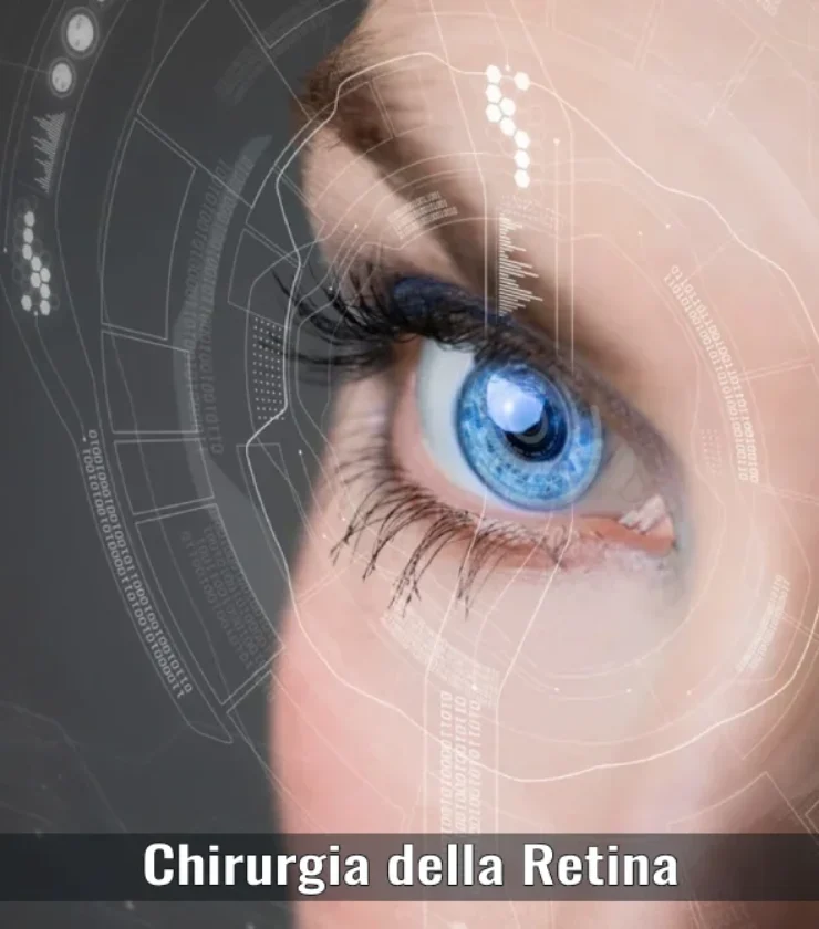 chirurgia-della-retina-oculistica-ranno-como-milano