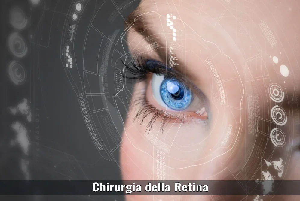 Chirurgia della Retina