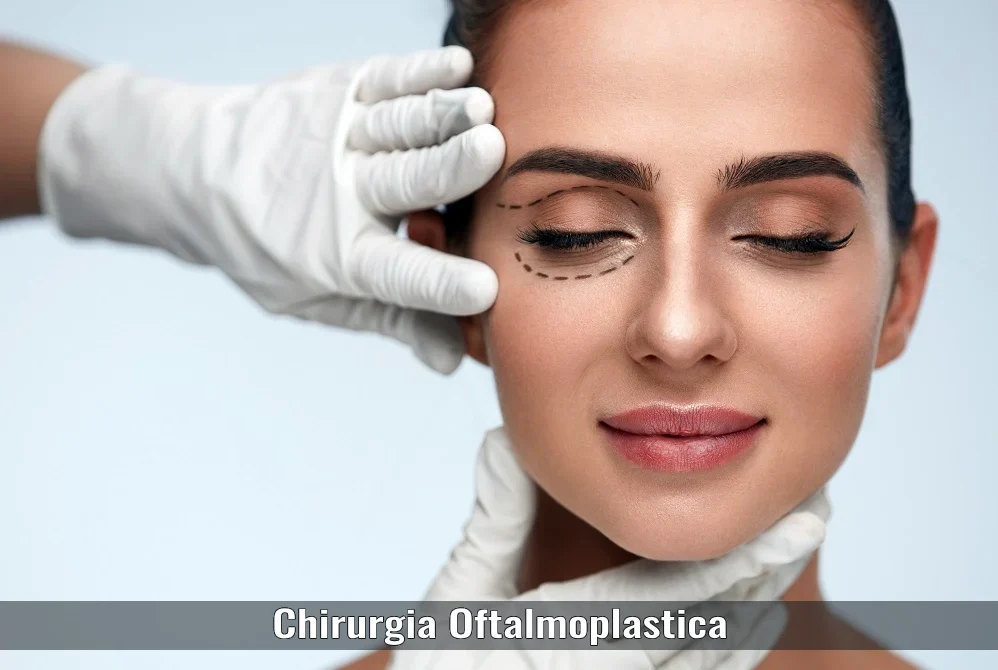 Chirurgia Oftalmoplastica