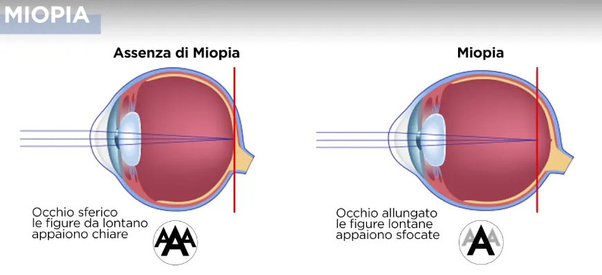 la-miopia-oculistica-ranno-como-milano-02