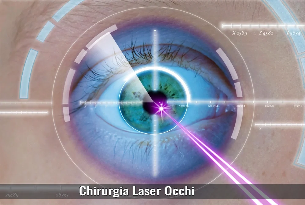Chirurgia Laser Occhi