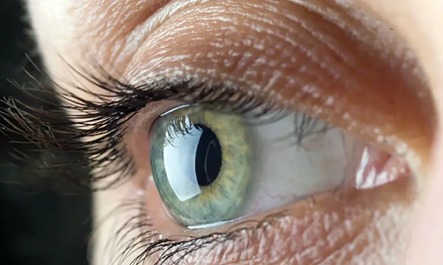 distacco-di-retina-dottor-stefano-ranno-oculista-como-milano